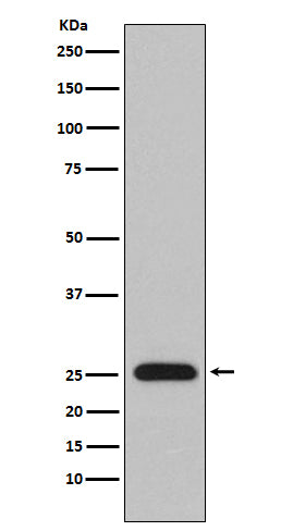 Lambda Light Chain Rabbit Polyclonal Antibody