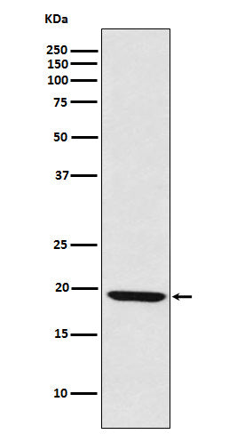 LMO2 Rabbit Polyclonal Antibody
