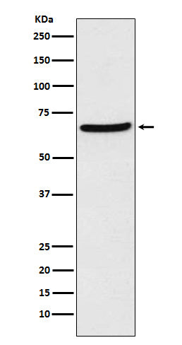 CDT1 Rabbit Polyclonal Antibody