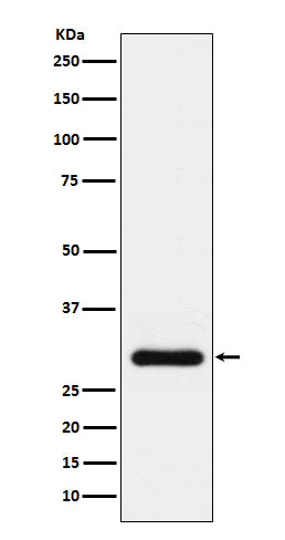 BNP Rabbit Polyclonal Antibody