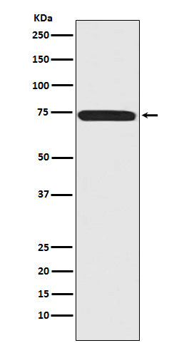 Menin Rabbit Polyclonal Antibody