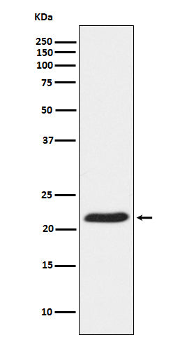TCTP Rabbit Polyclonal Antibody