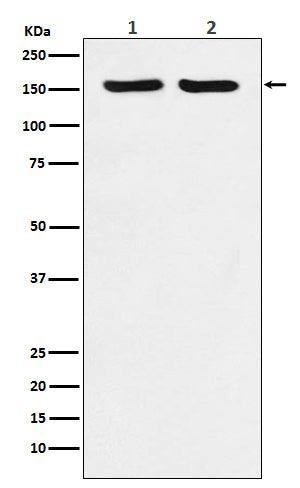 ROCK2 Rabbit Polyclonal Antibody