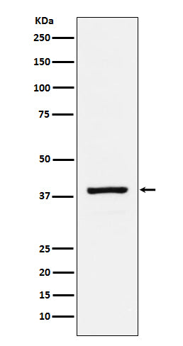 RASSF1 Rabbit Polyclonal Antibody