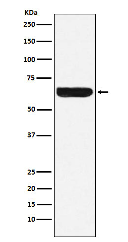 Placental Alkaline Phosphatase Rabbit Polyclonal Antibody