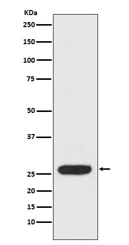 StAR Rabbit Polyclonal Antibody