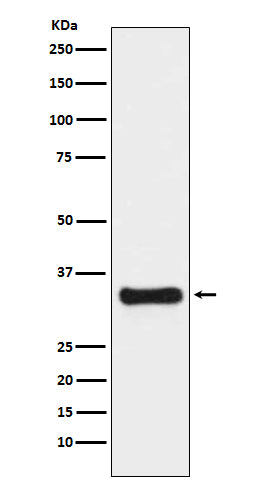 Thymidylate Synthase Rabbit Polyclonal Antibody