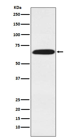 DDX5 Rabbit Polyclonal Antibody