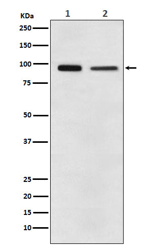 Elongation factor 2 Rabbit Polyclonal Antibody