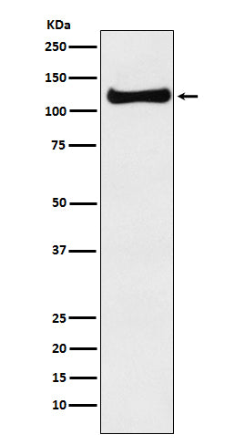 USP10 Rabbit Polyclonal Antibody