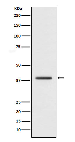 Macro H2A.1 Rabbit Polyclonal Antibody