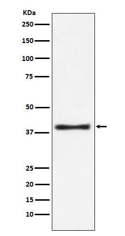 Aspartate Aminotransferase Rabbit Polyclonal Antibody