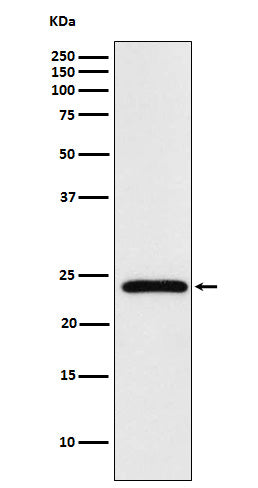 MAD2L2 Rabbit Polyclonal Antibody