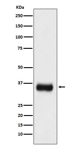SF2 Rabbit Polyclonal Antibody