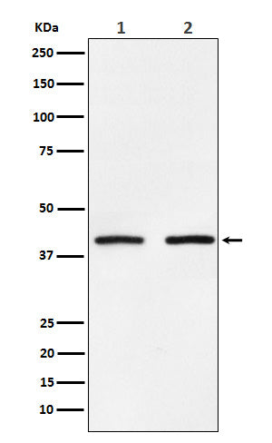 SMYD3 Rabbit Polyclonal Antibody