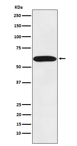 STIP1 Rabbit Polyclonal Antibody