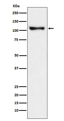 PSD93 Rabbit Polyclonal Antibody
