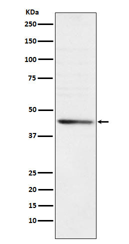 RRM2 Rabbit Polyclonal Antibody