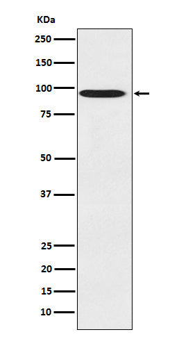 CDT2 Rabbit Polyclonal Antibody