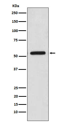 CaMKII beta Rabbit Polyclonal Antibody
