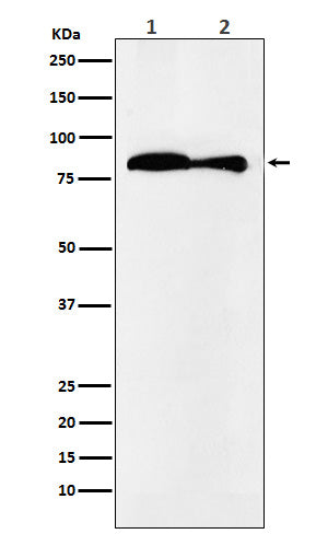 VPS35 Rabbit Polyclonal Antibody
