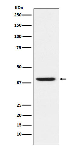 RING2 Rabbit Polyclonal Antibody