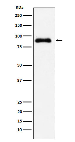 SATB2 Rabbit Polyclonal Antibody