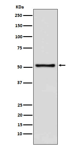 DNA Nucleotidylexotransferase Rabbit Polyclonal Antibody