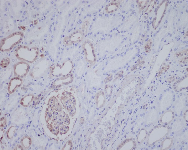 ALK Rabbit Polyclonal Antibody