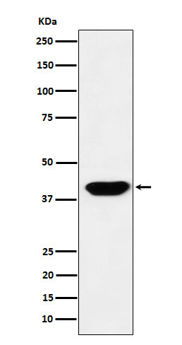 Islet 1 Rabbit Polyclonal Antibody