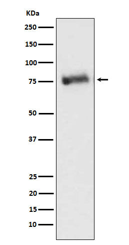 GRK3 Rabbit Polyclonal Antibody