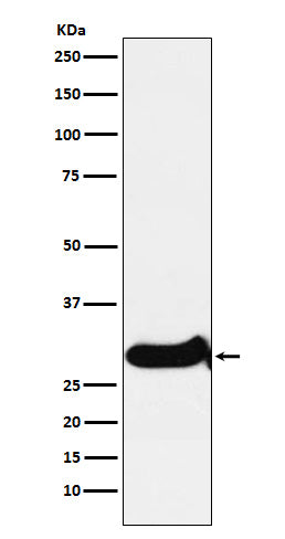 IGFBP7 Rabbit Polyclonal Antibody