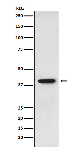 SET Rabbit Polyclonal Antibody