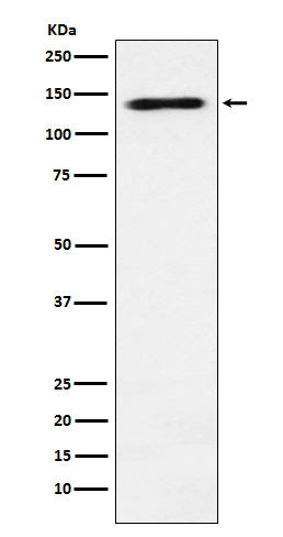 RNA Helicase A Rabbit Polyclonal Antibody