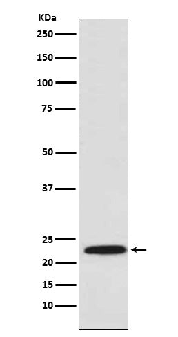 Proteasome beta 8 Rabbit Polyclonal Antibody