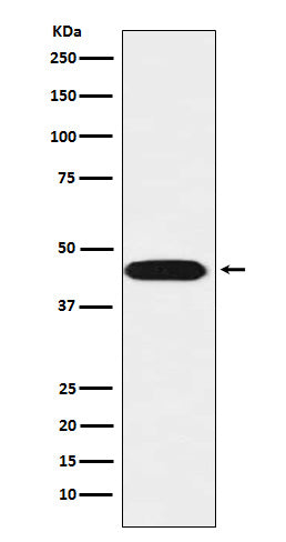 LIS1 Rabbit Polyclonal Antibody