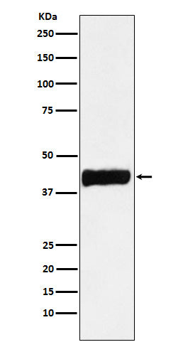 Creatine Kinase B type Rabbit Polyclonal Antibody