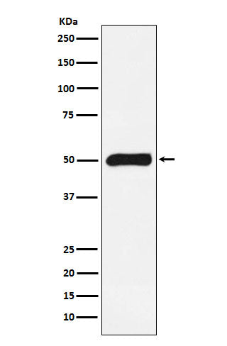 FKBP51 Rabbit Polyclonal Antibody