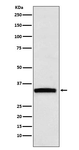 GDF15 Rabbit Polyclonal Antibody