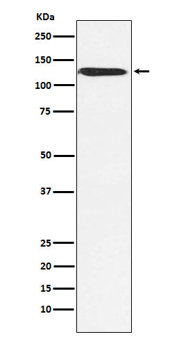 SMARCA5 Rabbit Polyclonal Antibody