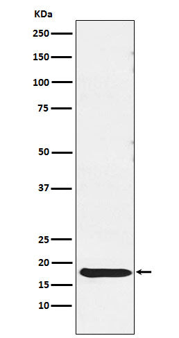 Thyrotropin Subunit beta Rabbit Polyclonal Antibody
