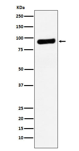 RRM1 Rabbit Polyclonal Antibody
