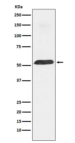 PTBP1 Rabbit Polyclonal Antibody