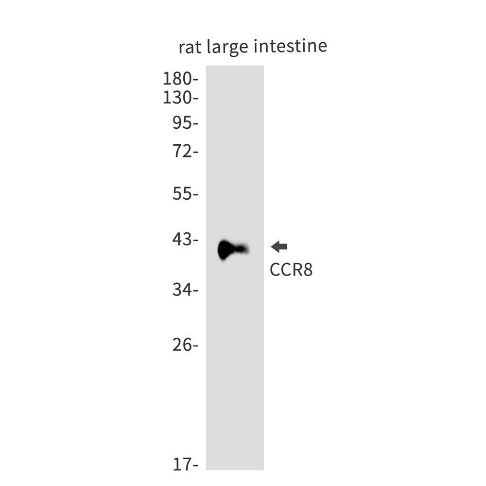 CCR8 Rabbit Polyclonal Antibody