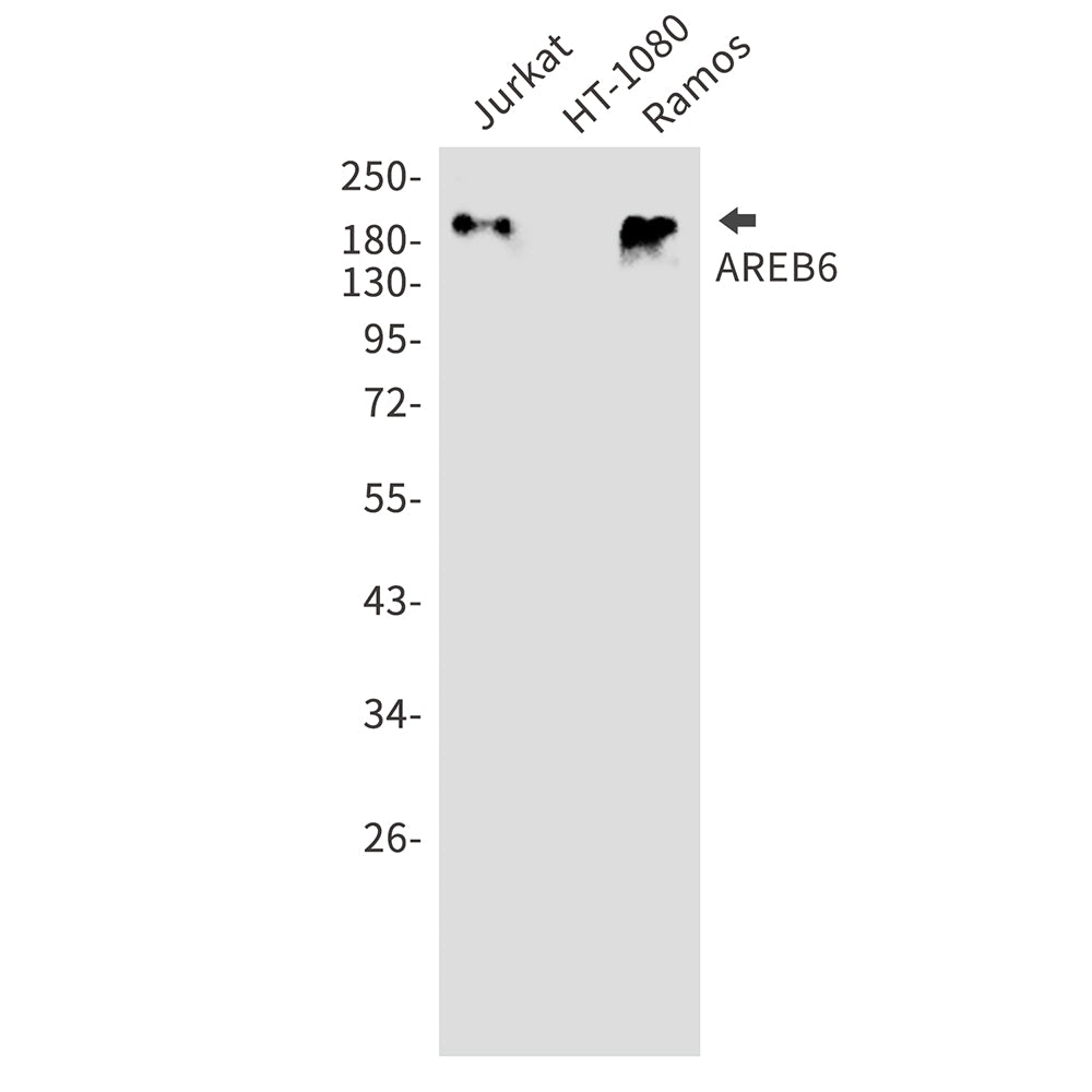 ZEB1 Rabbit Polyclonal Antibody