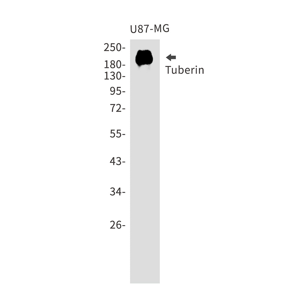 Tuberin Rabbit Polyclonal Antibody