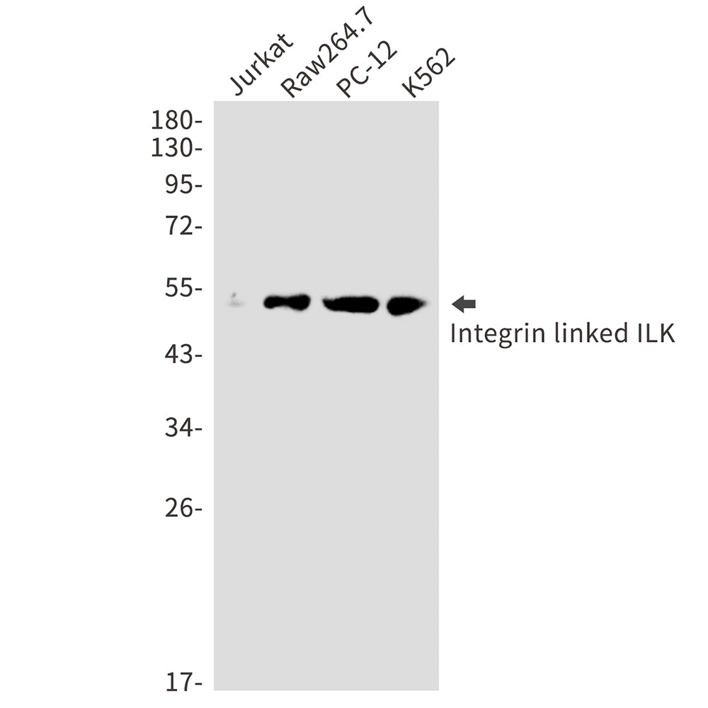 ILK Rabbit Polyclonal Antibody