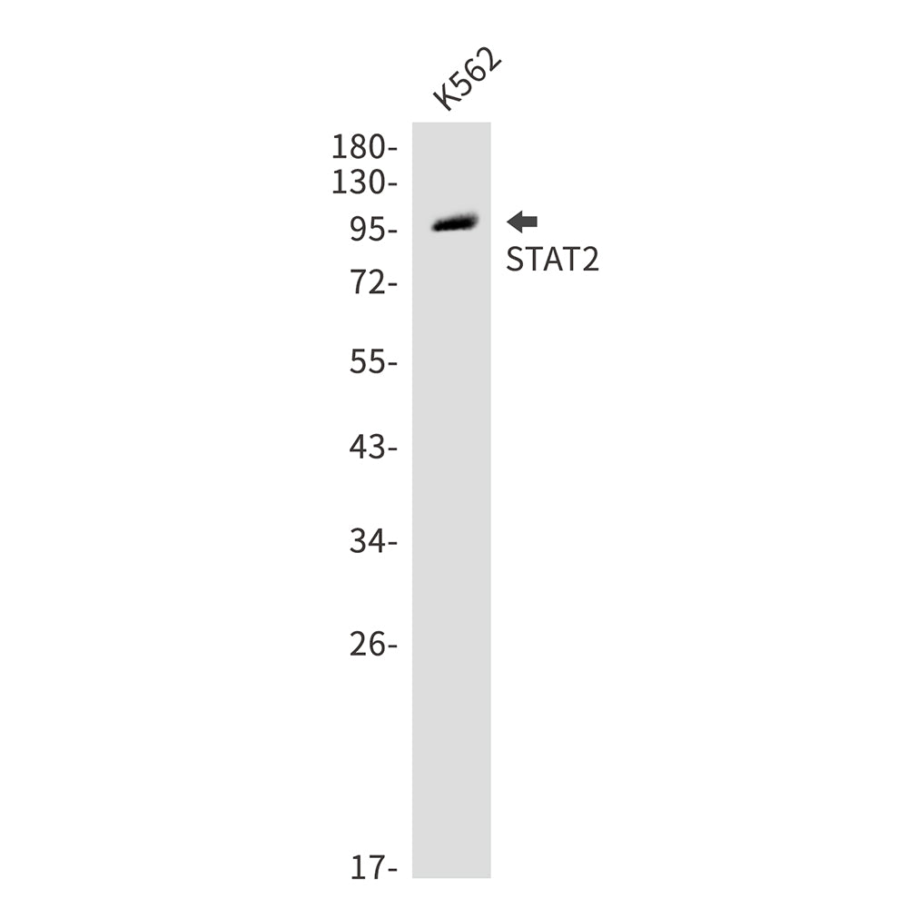 STAT2 Rabbit Polyclonal Antibody