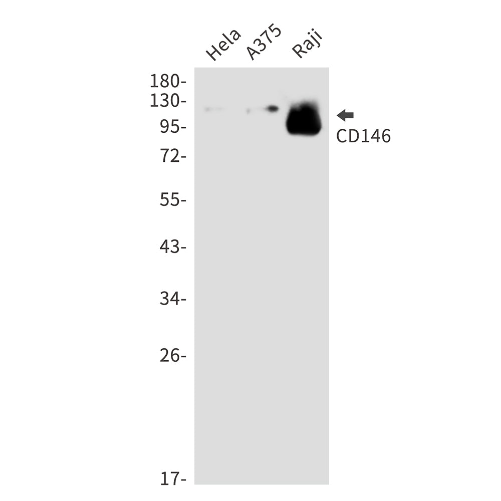 CD146 Rabbit Polyclonal Antibody