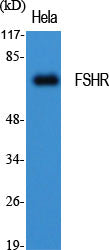 FSHR Rabbit Polyclonal Antibody